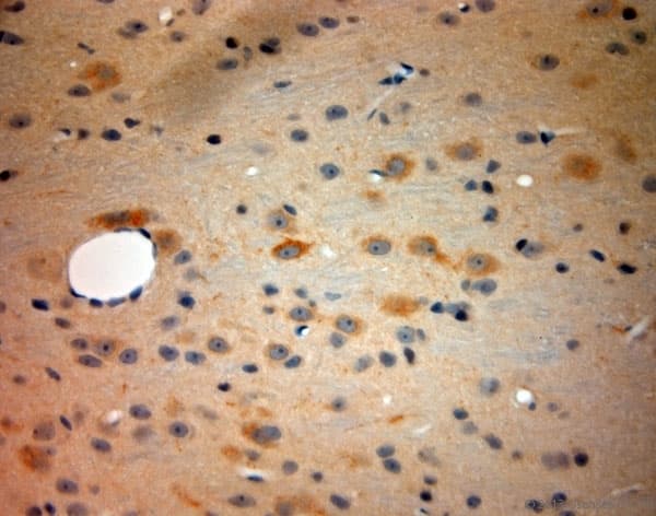 TACR1 / NK1R Antibody (aa150-200)