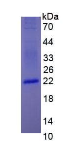 Rat IFNA1 / Interferon Alpha 1 Protein (Recombinant His, N-Terminal)
