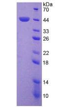 Mouse PRKCD / PKC-Delta Protein (Recombinant His-T7)