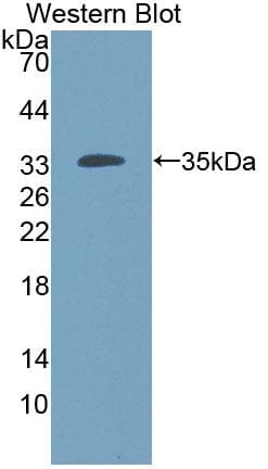 Proenkephalin / PENK Antibody
