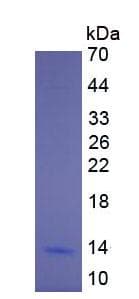 Cow IL8 / Interleukin 8 Protein (Recombinant His, N-Terminal)