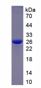 Human CHI3L1 / YKL-40 Protein (Recombinant His-T7)