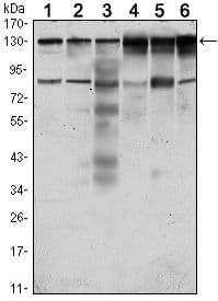 Monoclonal Mouse anti-Human CCK4 / PTK7 Antibody (clone 4F9, IHC, WB)