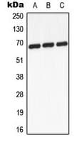 GCKR Antibody (Internal)