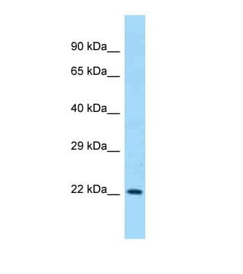 CD200 Antibody (aa175-224)