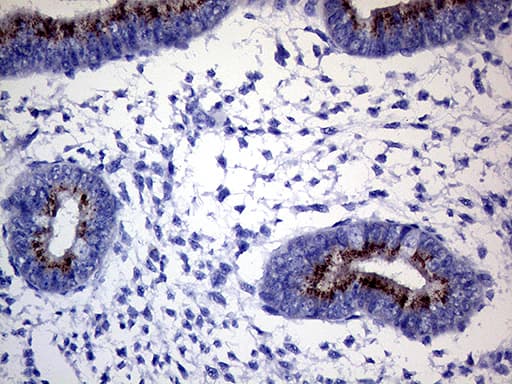 GALNT10 Antibody (aa1-318, clone OTI2A12)