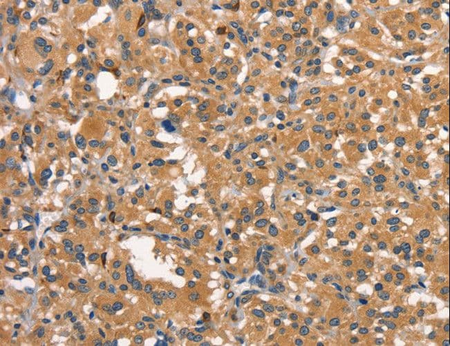 Polyclonal Rabbit anti-Human DNM2 / Dynamin-2 Antibody (IHC, WB)