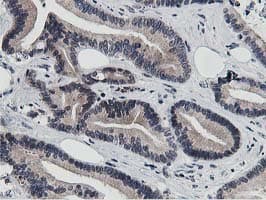 Dipeptidyl Peptidase 3 / DPP3 Antibody (clone OTI2D9)