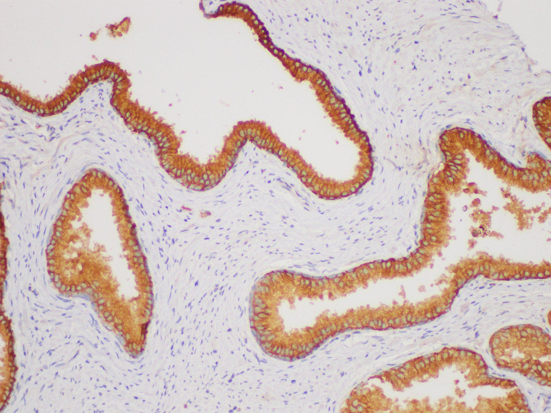 CD38 Antibody