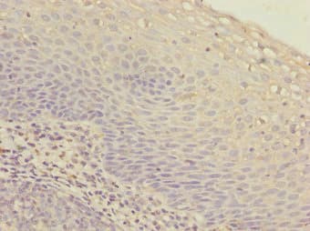 Polyclonal Rabbit anti-Human IKBIP Antibody (IHC, WB)