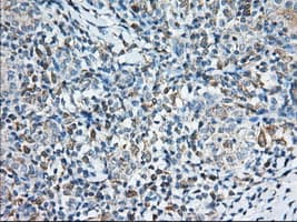 TTC32 Antibody (clone OTI5B6)