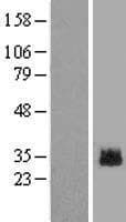 GLIPR1L2 Protein (Over-Expression Lysate Myc-DDK (Flag))