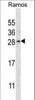 Polyclonal Rabbit anti-Human RAB21 Antibody (aa168-197, IHC, WB)