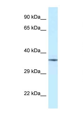 NUDT6 Antibody (aa109-158)
