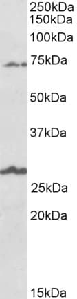IHC-plus™ Polyclonal Goat anti-Human SLC6A12 / BGT-1 Antibody (aa587-601, IHC, WB)