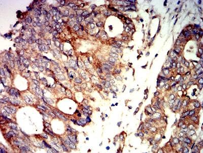 PRKAB2 / AMPK Beta 2 Antibody (clone 8F5B2)