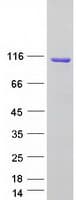 Human CYLD Protein (Recombinant Myc-DDK (Flag))