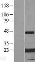 CRYAB / Alpha B Crystallin Protein (Over-Expression Lysate Myc-DDK (Flag))