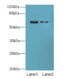 IHC-plus™ Polyclonal Rabbit anti-Human SLC1A6 / EAAT4 Antibody (IHC, WB)