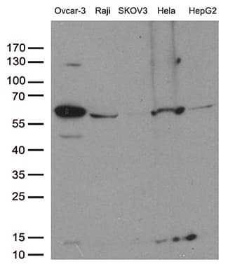 Monoclonal Mouse anti-Human FOXO1 / FKHR Antibody (clone OTI2C6, aa356-655, WB)