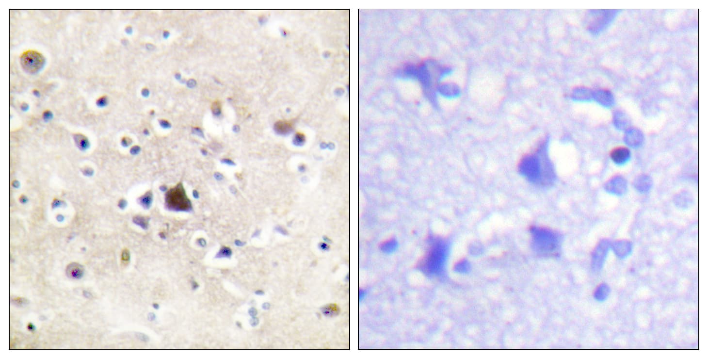 NR3C1/Glucocorticoid Receptor Antibody (aa201-250)