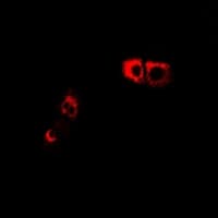 NMUR1 Antibody