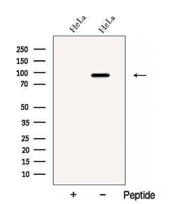 CARNS1 Antibody