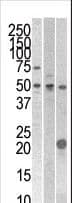 STYK1 Antibody (aa31-64)