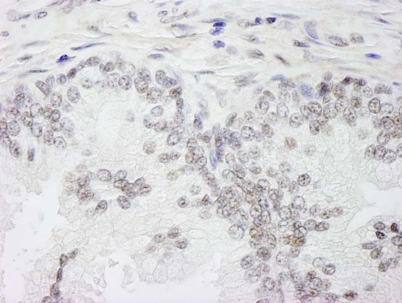 WTAP Antibody (aa346-396)
