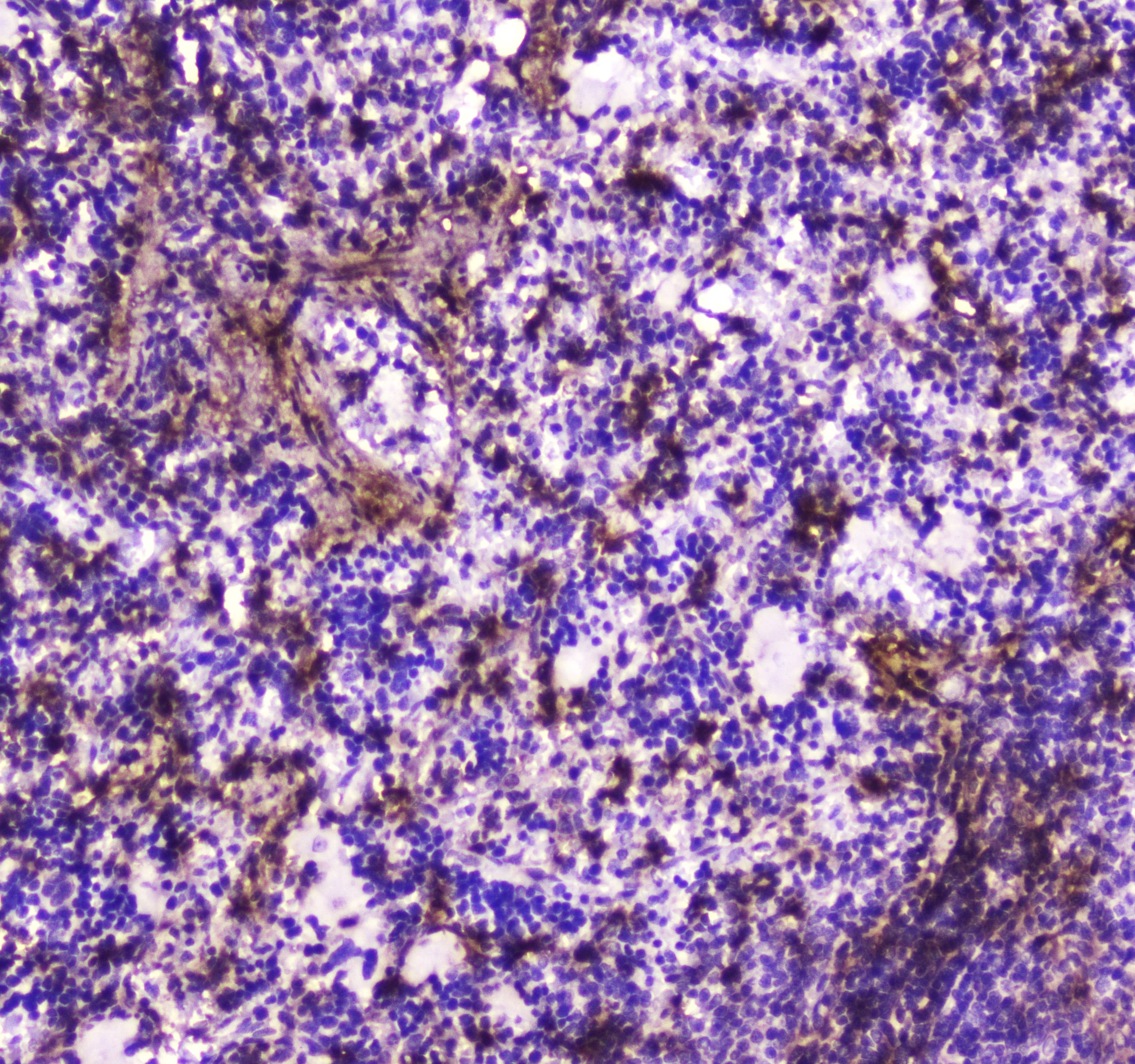 Polyclonal Rabbit anti-Human ANXA6/Annexin A6/Annexin VI Antibody (IHC, WB)