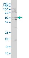 Monoclonal Mouse anti-Human BAAT / BAT Antibody (clone 5B6, WB)