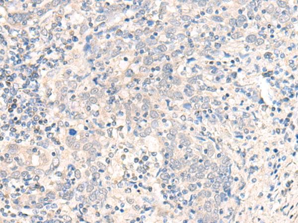 Polyclonal Rabbit anti-Human CCDC47 Antibody (IHC, WB)