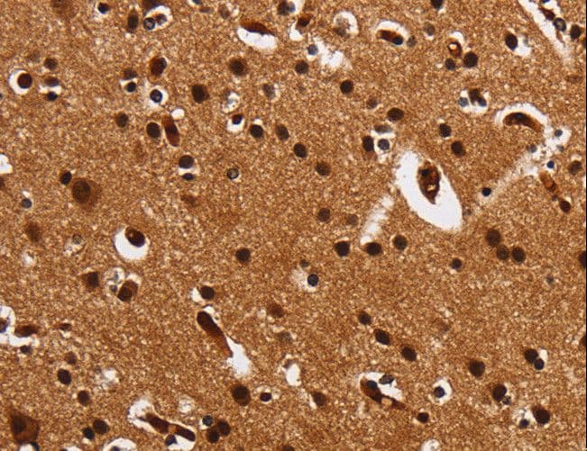UPK3B Antibody