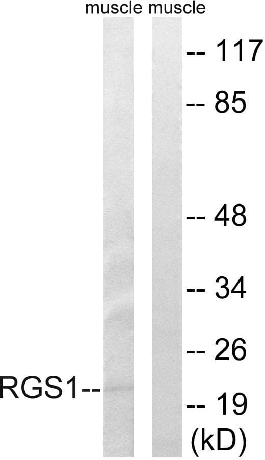 RGS1 Antibody
