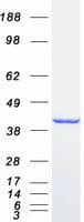 Human ABHD5 Protein (Recombinant Myc-DDK (Flag))