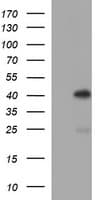 SERPINB3 Antibody (clone OTI1A5)