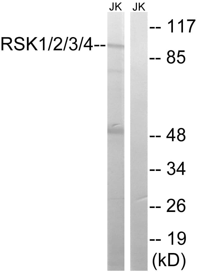 RSK1+2+3+4 Antibody (aa191-240)