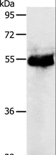 PRKAR1B Antibody