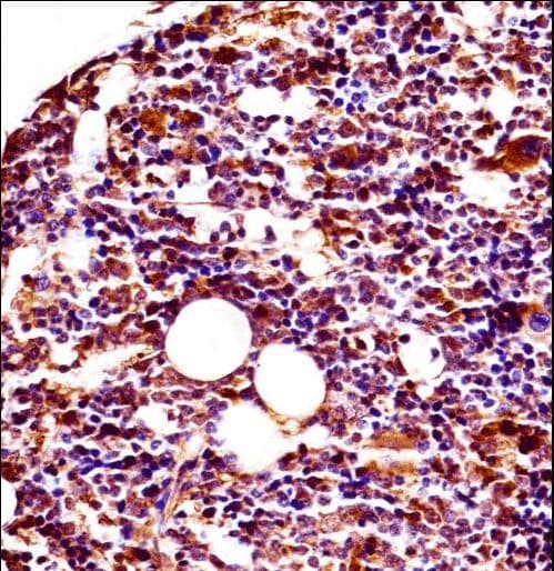 LYN Antibody (aa1-30)
