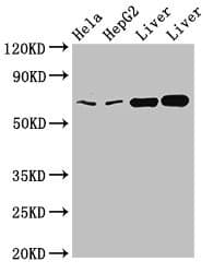 Polyclonal Rabbit anti-Human CLINT1 Antibody (IHC, WB)