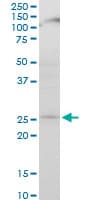 APG5 / ATG5 Antibody (clone 1G11)