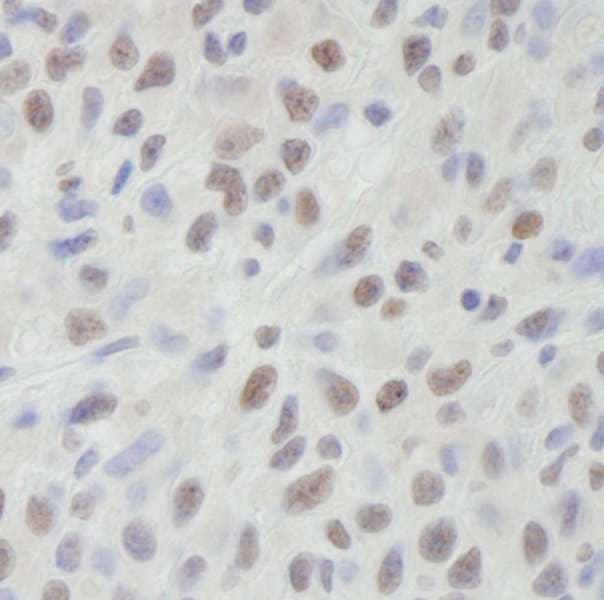 DHX9 Antibody (aa1220-C-term)