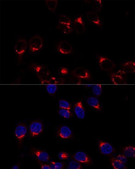 Polyclonal Rabbit anti-Human US01 / p115 Antibody (IF, WB)