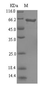 Pseudomonas aeruginosa L-ornithine 5-monooxygenase Protein (Recombinant 6His-SUMO, N-terminus)
