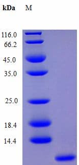 Human CXCL4 / PF4 Protein (Recombinant)