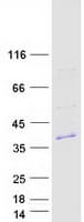 Human FAM212B Protein (Recombinant Myc-DDK (Flag))