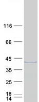 Human GEM / KIR Protein (Recombinant Myc-DDK (Flag))