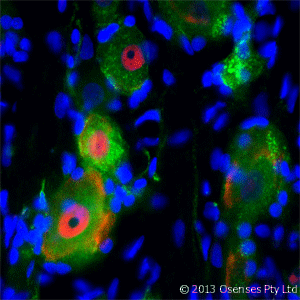 NGFR / CD271 / TNR16 Antibody (clone MC192)