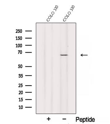 SLC11A2 / DMT1 Antibody