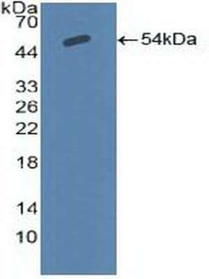 SCNN1A / ENaC Alpha Antibody (aa112-543, PE)